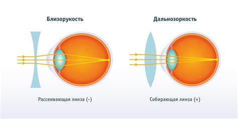 Определение необходимости операции на зрение