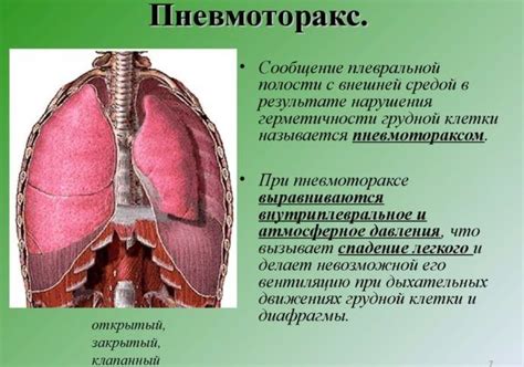 Осложнения, которые могут возникнуть при наличии поражения C10 в правой доле легких