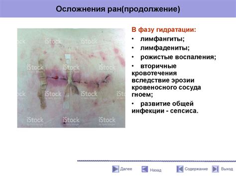 Осложнения при заживлении ран