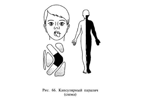 Основные аспекты исследования нервной системы у ребенка: ключевые моменты в диагностике