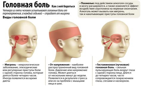 Основные причины головной боли от переутомления