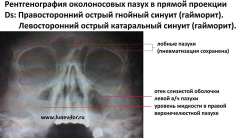 Основные факторы, вызывающие появление насморка у пациентов