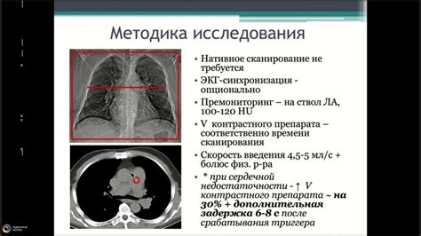 Основы интерпретации границ легочных зон на флюорографии