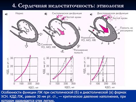 Особенности клинической картины при сохранении глобальной систолической функции лж