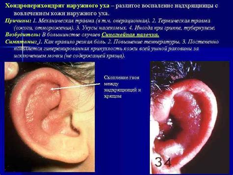 Открытость сосудов и влияние на цвет кожи уха