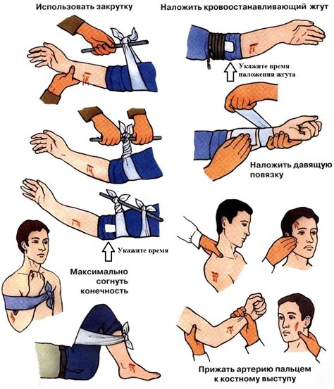 Первая помощь: остановка кровотечения
