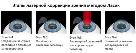 Перспективы оперативного вмешательства и лазерной коррекции