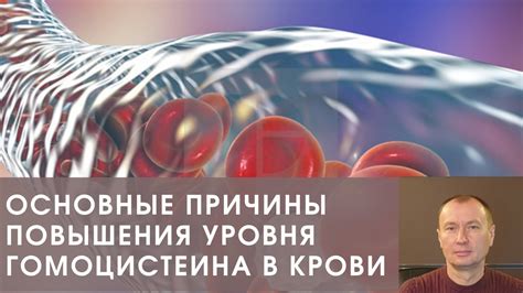 Последствия пониженного уровня гомоцистеина