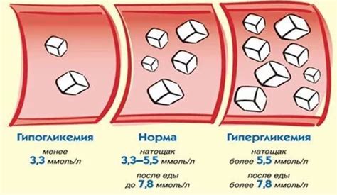 Потенциальные причины повышенного уровня глюкозы