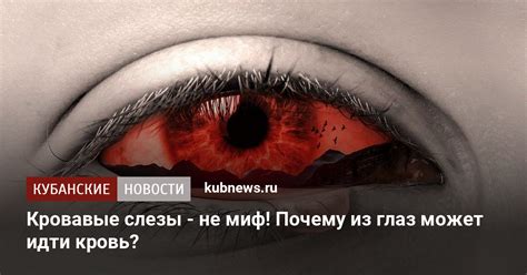 Почему глаз может налиться кровью и болеть: основные причины