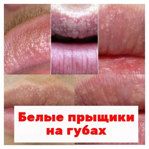 Почему нижняя губа на лице вызывает зуд: причины и возможные решения