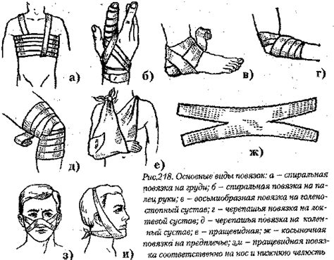 Применение стерильных повязок