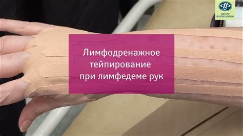 Применение холода для уменьшения отека при повреждении конечности