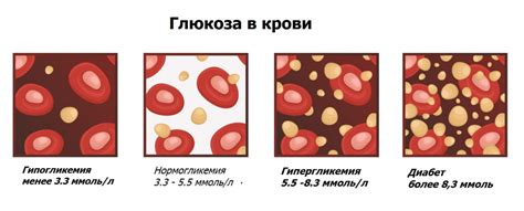 Причины внезапного снижения содержания глюкозы в крови