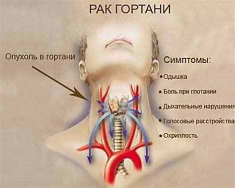 Причины возникновения зуда в области горла и плечей