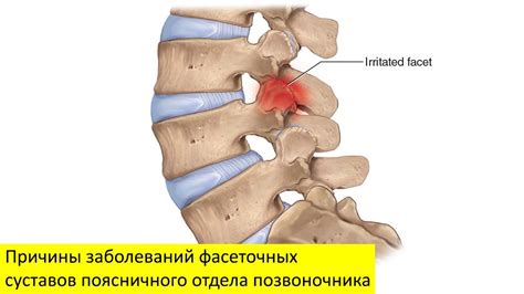 Причины заболеваний нижнего отдела спинного столба