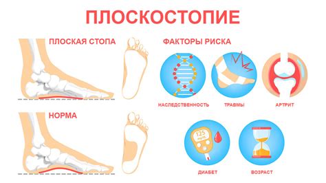 Причины появления трепетаний в левой стопе