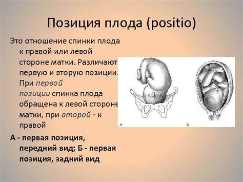 Продольное предлежание головное: особенности и характеристики