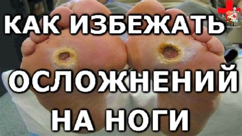 Профилактика гниющей ноги при диабете