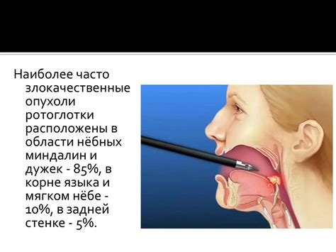 Процесс образования глотки луженой