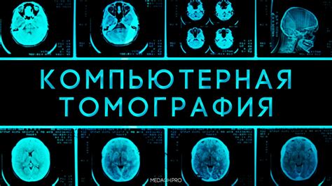 Процесс формирования изображения при помощи компьютерной томографии