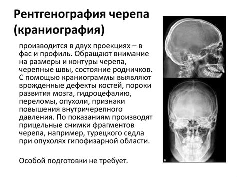 Рентгенография черепа: эффективный метод оценки состояния центральной нервной системы