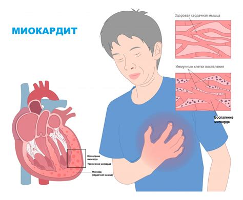 Роль массажа в смягчении ощущения стеснения в грудной клетке