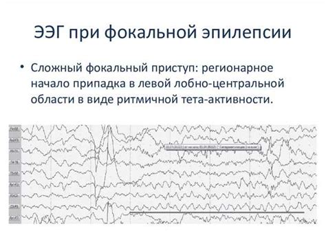 Роль электроэнцефалографии с нагрузочными пробами в клинических исследованиях