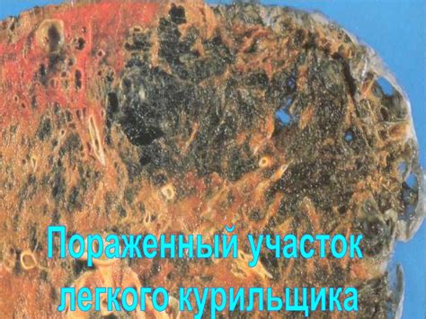 Рост количества заболеваний, связанных с употреблением продуктов животного происхождения