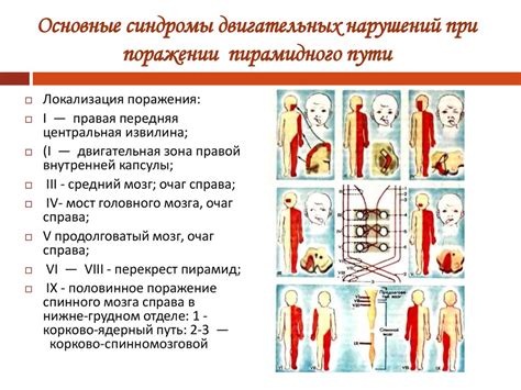 Свойства и особенности движения с учетом области поражения