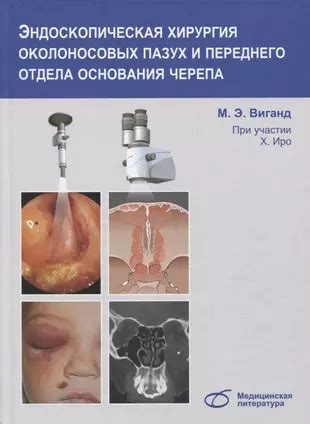 Связь околоносовых пазух с дыхательной системой и носоглоткой