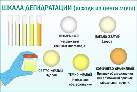 Симптомы и диагностика изменения цвета мочи у представителей мужского пола