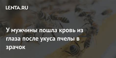 Симптомы и осложнения после укуса пчелы в область головы