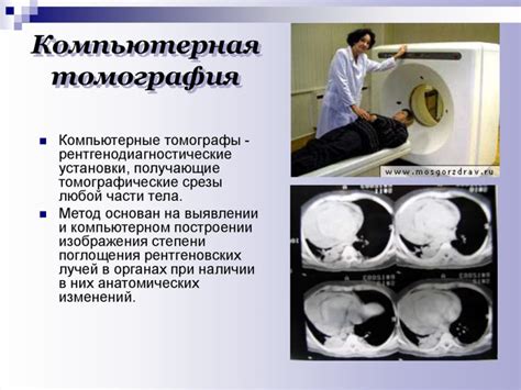 Современные методы исследования для точной диагностики финальной кардиомиопатии