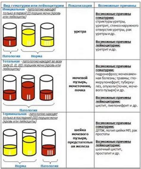 Содержание информации в результатах исследования мочи на культуру и чувствительность