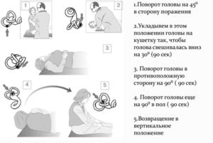 Способы лечения головокружения