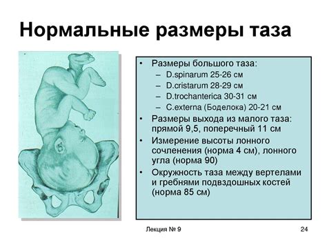 Тазовое деформирование как причина сужения родового прохода у женщин