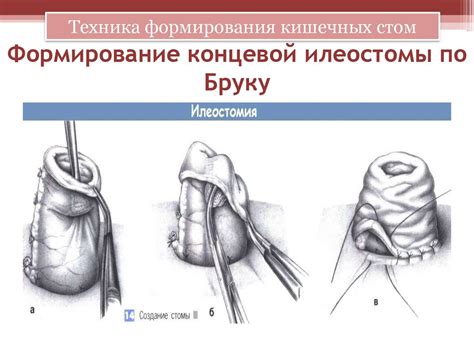 Технические аспекты формирования интересного обложки альбома с использованием нейроинтерфейса