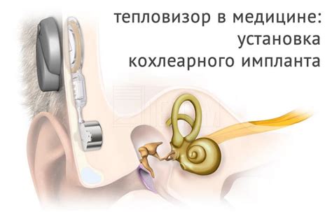 Типы стежек, применяемые при хирургическом вмешательстве над мужскими собаками