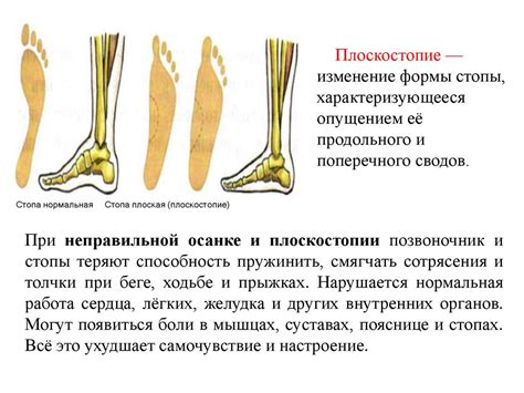 Травма, неправильная осанка и монотонные движения