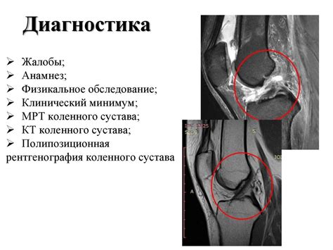 Травмы и повреждения коленного сустава