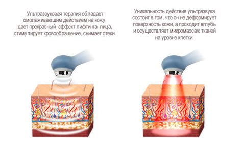 Ультразвуковая терапия и радиочастотное омоложение: безболезненные и эффективные процедуры