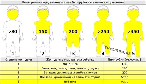 Факторы, воздействующие на уменьшение общего уровня билирубина у малыша