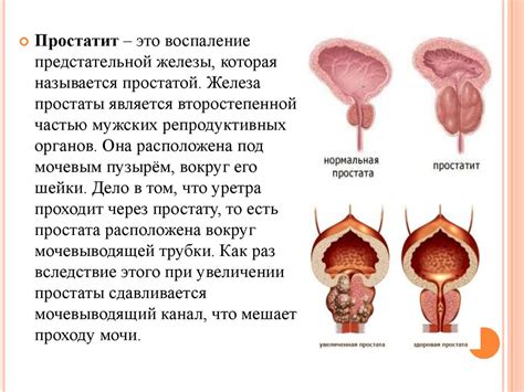 Факторы, способствующие развитию гладкостенной серозной цистаденомы