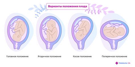 Факторы повреждений плода на протяжении беременности как потенциальный риск для возникновения ДМЖП