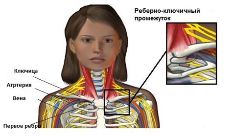 Физические причины, такие как повреждения нервов или мышц
