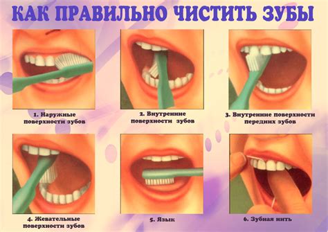 Шаг 3: Правила применения йодного раствора для ухода за полостью рта