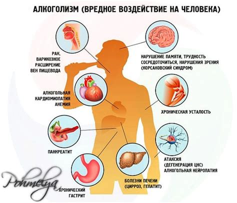 7 методов противодействия чрезмерному пристрастию к употреблению соли